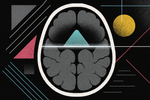 The Mount Fuji Sign: When a Landmark on a Brain Scan Becomes a Neurosurgical Emergency