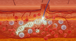 Your Sunburn Isn't Your Skin 'Cooking' — It's Your Body's Emergency Rescue Mission
