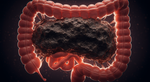 When the Body Becomes a Prison: The Terrifying Reality of Extreme Constipation